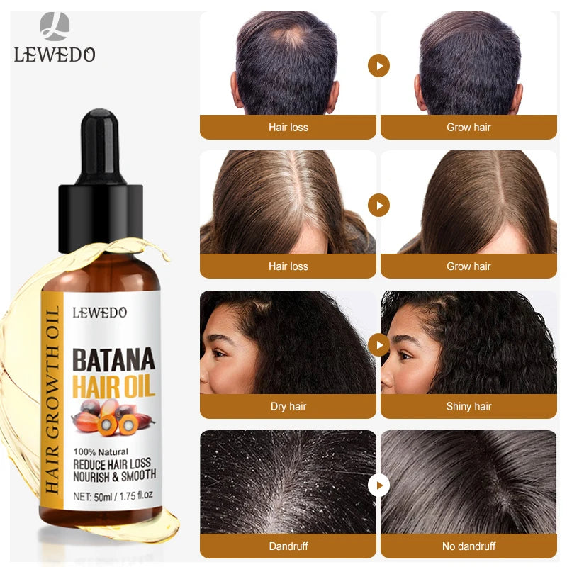 Sérum de Crescimento Capilar com Batana Oil — Anti-Queda, Reparador e Estimulante Natural