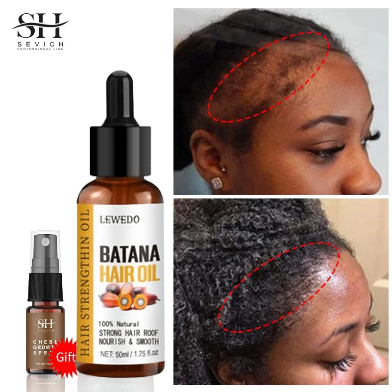 Sérum de Crescimento Capilar com Batana Oil — Anti-Queda, Reparador e Estimulante Natural