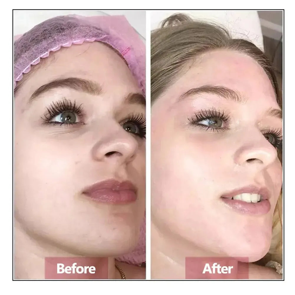 Sérum Facial de Ácido Hialurônico — Rejuvenescedor, Firmador e Hidratante para Pele Jovem e Saudável