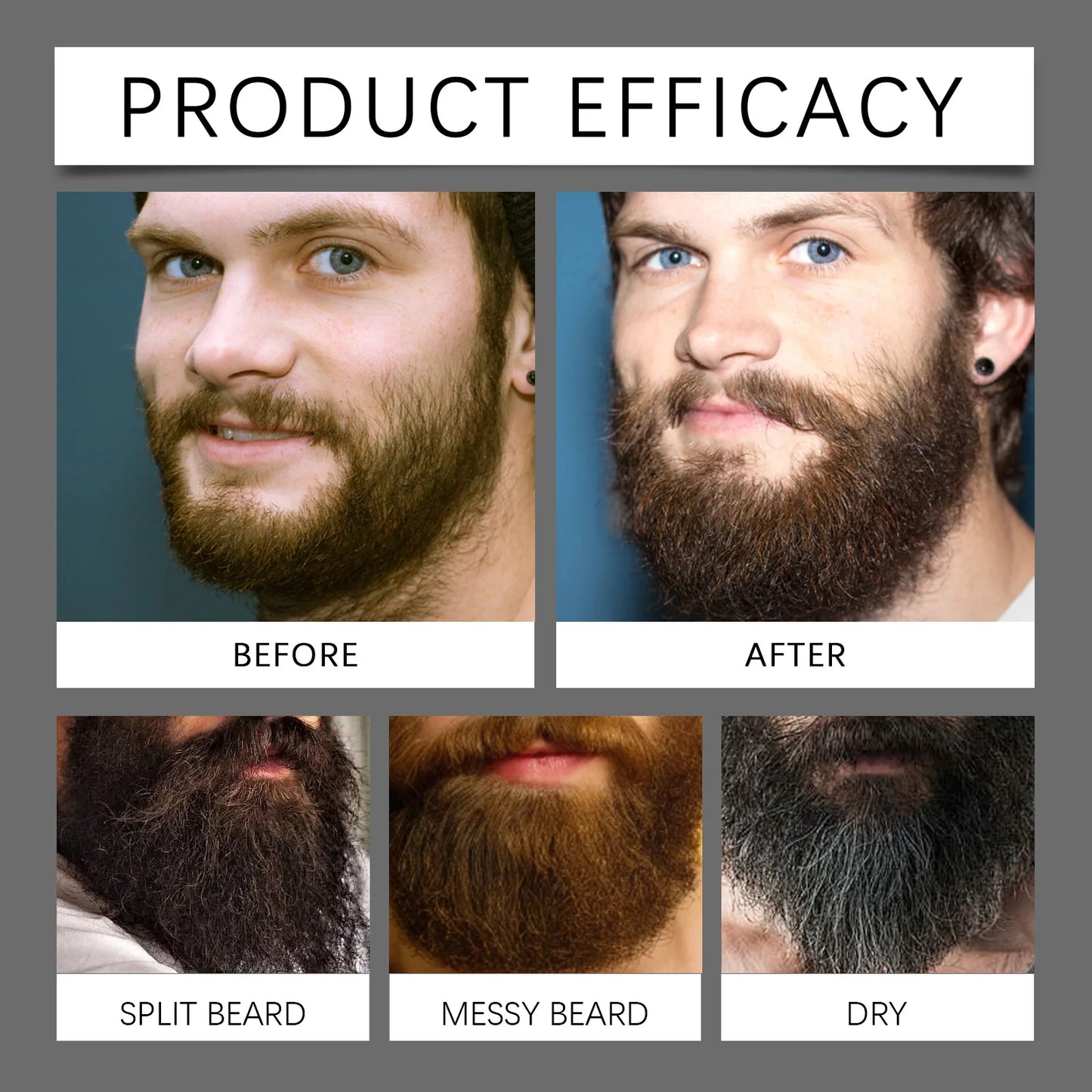 Sérum para Crescimento de Barba — Espessante, Fortalecedor de Raízes e Hidratante Masculino