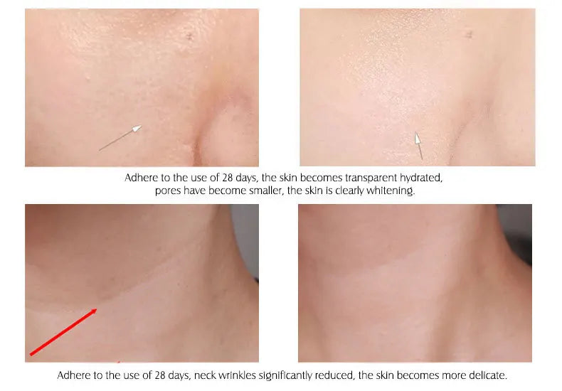 Sérum Facial de Ácido Hialurônico — Hidratante, Firmador e Restaurador da Elasticidade da Pele