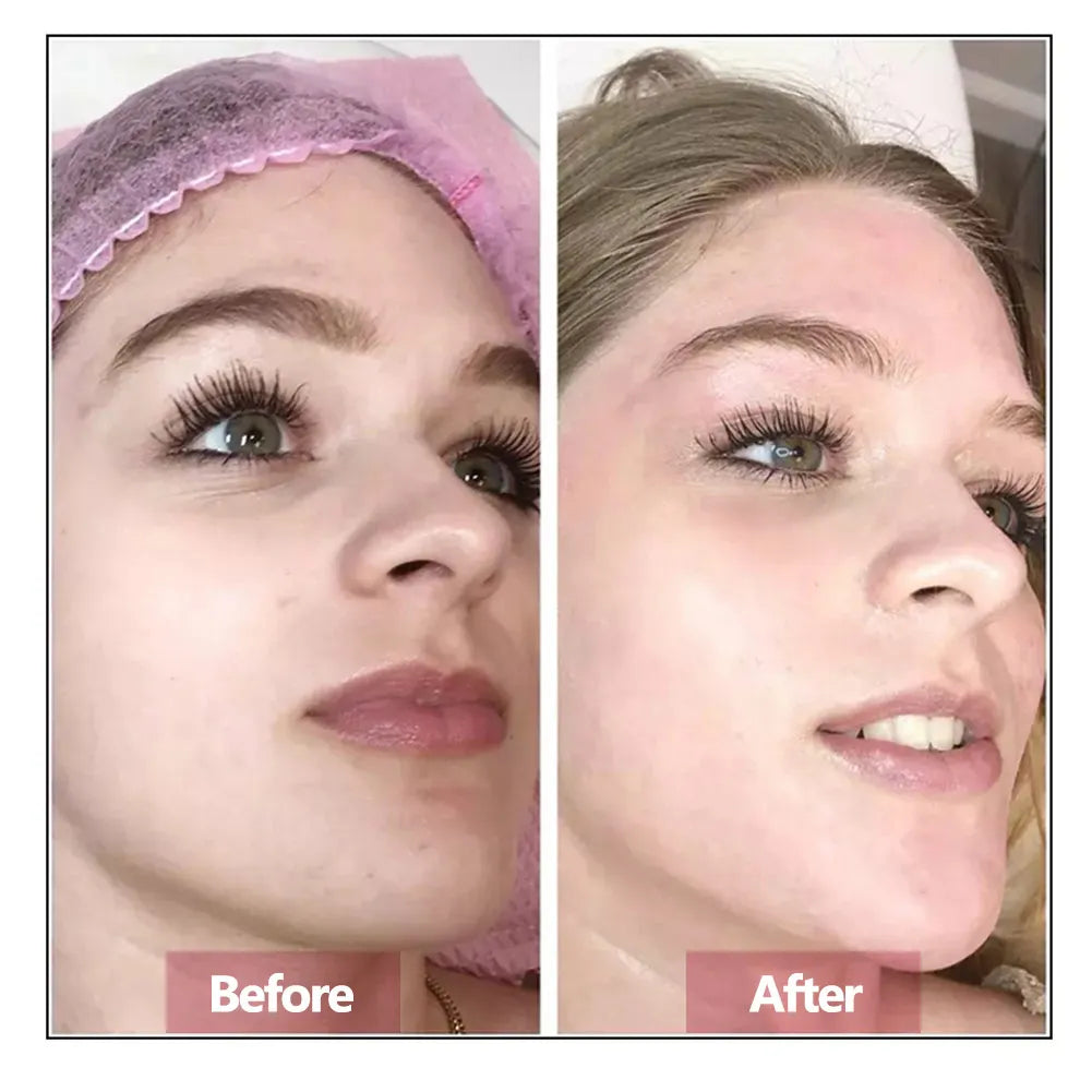 Sérum Facial de Ácido Hialurônico — Rejuvenescedor, Firmador e Hidratante para Pele Jovem e Saudável