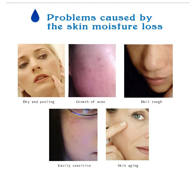 Sérum Facial de Ácido Hialurônico — Hidratante, Firmador e Restaurador da Elasticidade da Pele