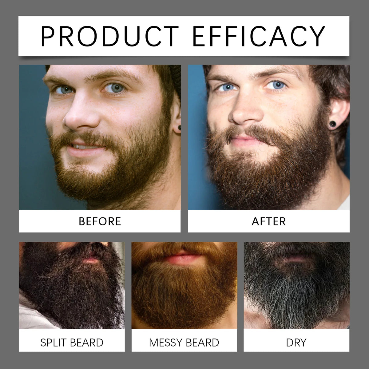 Sérum para Crescimento de Barba — Espessante, Fortalecedor de Raízes e Hidratante Masculino 4